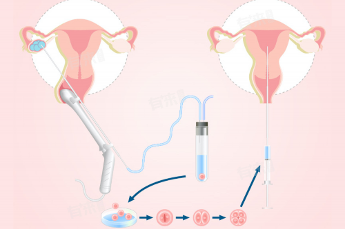 大连市借卵试管医院排名！附供卵包生男孩价格明细