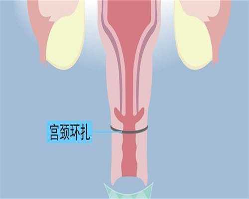 格鲁吉亚借卵试管婴儿可以生儿子，采用三代试管PGD技术即可！