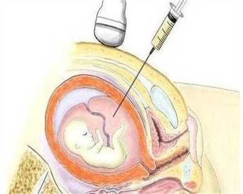 孕宝代孕+坤和代生孩子的流程,做试管婴儿一般多少费用 [前期检查费用贵吗