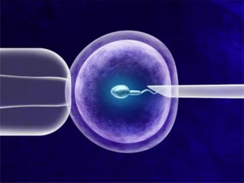 代孕公司哪里好,无精子症男性利用试管二代助孕后是不是都生女儿？